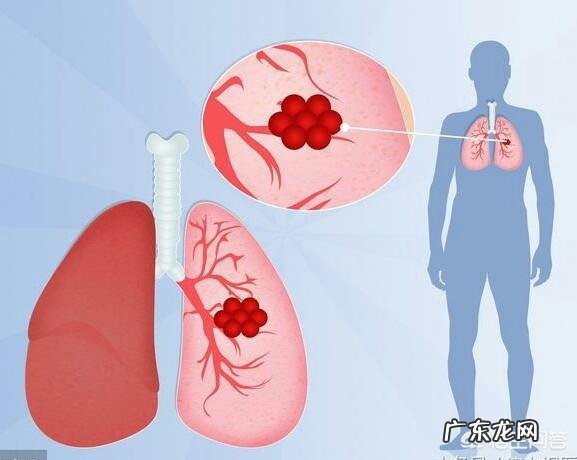 夜间睡觉爱出汗有哪些原因呢?