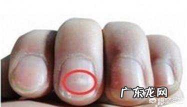 指甲上有横纹是怎么回事?