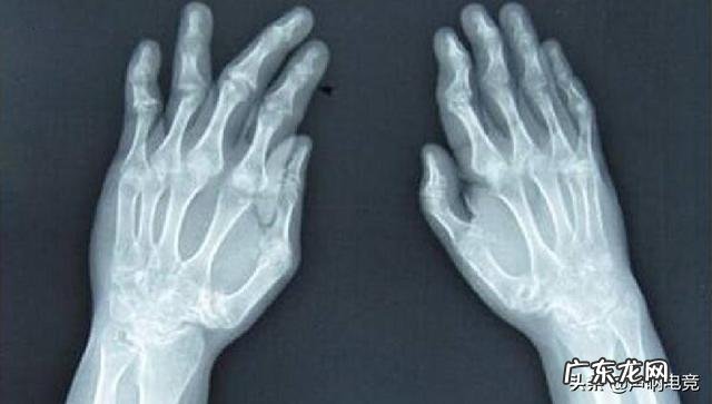 LOL百万粉主播透露“RNG内幕”:Uzi恐将休赛一整年,原因太委屈,是否会无缘S10?