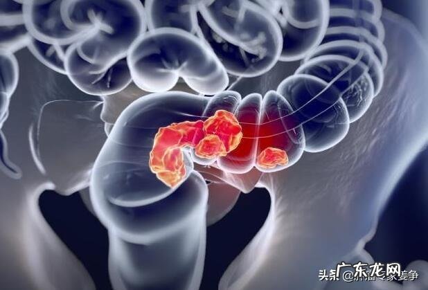 肠道不好的人会有什么症状?