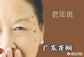 老年斑是怎么回事?