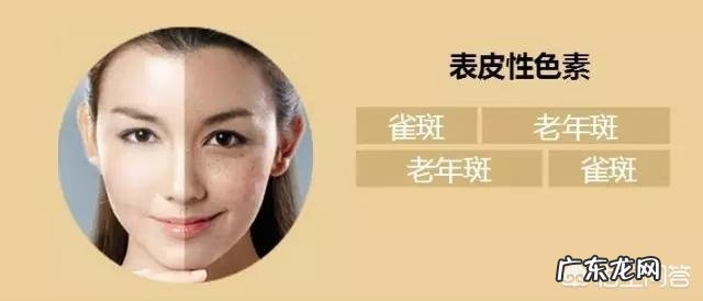 老年斑是怎么回事?