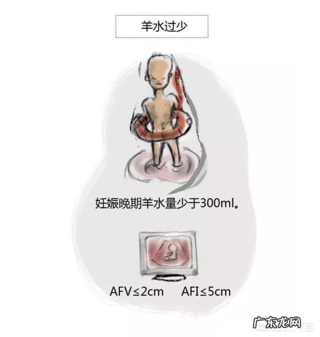 孕妇的羊水过多或过少会给胎儿和孕妇带来哪些影响?