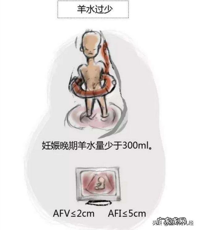 孕妇的羊水过多或过少会给胎儿和孕妇带来哪些影响?