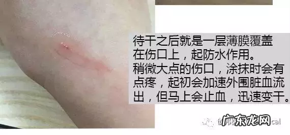 日本液体创可贴 液体创可贴可以用在脸上吗