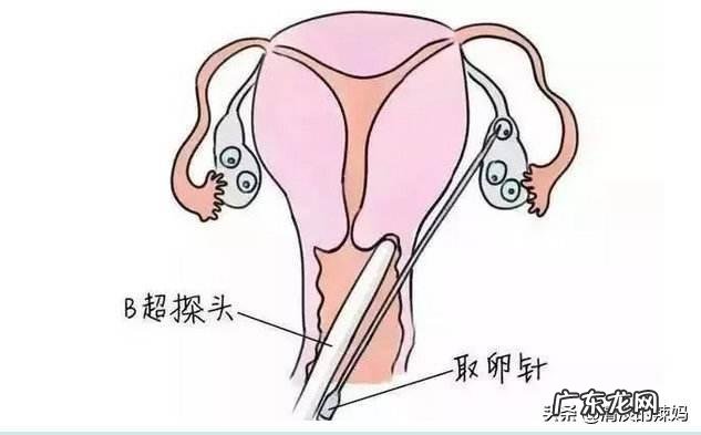 她 如果你的小孩是试管婴儿，你会告诉他实情吗？