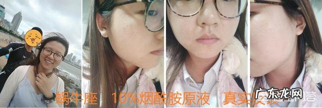 除了美白针，还有哪些美白方法？