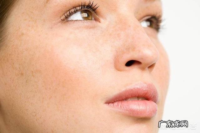 黄褐斑、雀斑、老年斑主要有哪些表现?如何区分?