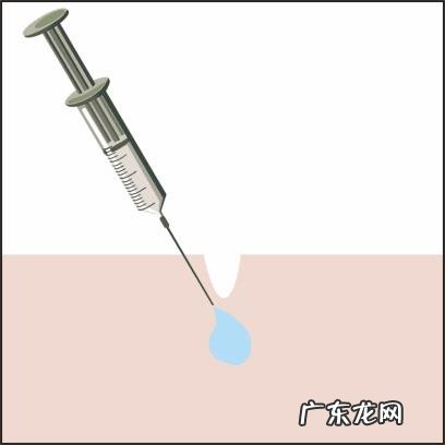 脸上皱纹怎么去除?延缓衰老的最好方法?