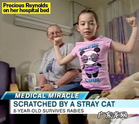 狂犬病发作了还有救吗?