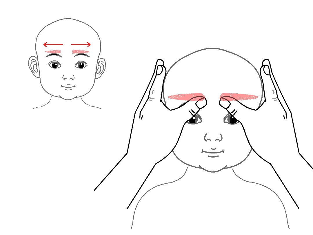 小孩反复发烧怎么办怎样退烧快小