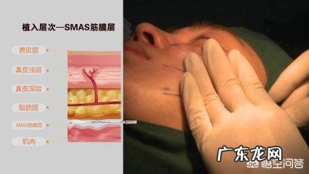 面部埋线的后遗症?