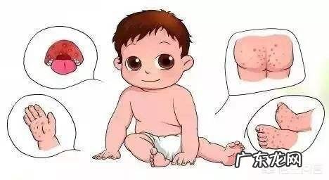 手足口病同期上升89.52%,如何科学预防儿童手足口病?