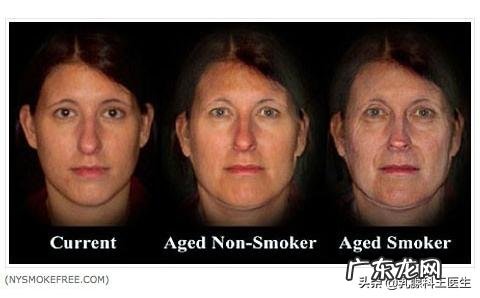 生活中的哪些细节会加速皮肤的衰老?