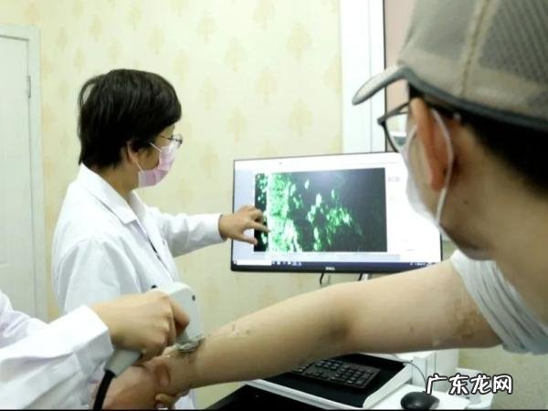 20多年胎记缠身 年轻小伙终获祛记曙光 祛胎记医院