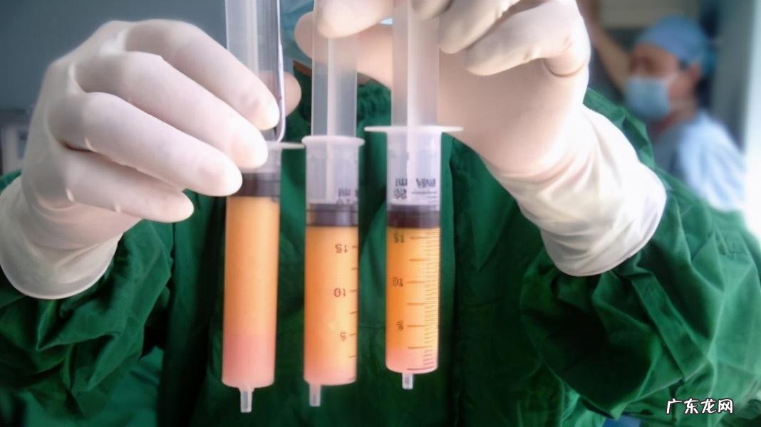 吸脂怎么吸 吸脂减肥效果怎么样