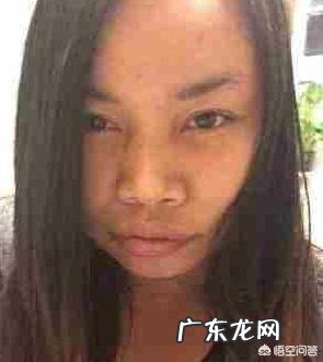 大家觉得长雀斑是不是很丑?