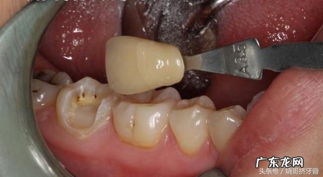 现在牙科为什么那么贵?