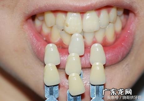 现在牙科为什么那么贵?