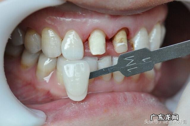 现在牙科为什么那么贵?