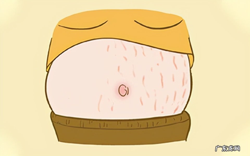 妊娠纹去哪里去除 去除妊娠纹的产品