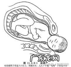 国家对难产的定义 难产的定义是什么