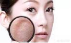 毛孔粗大该如何有效的改善?