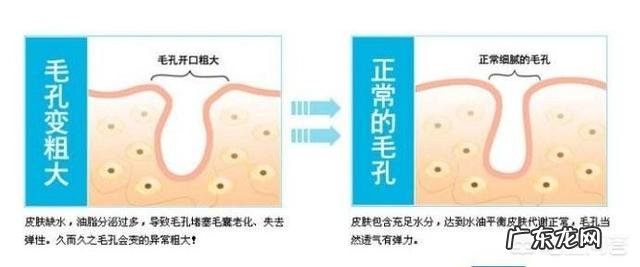 毛孔粗大该如何有效的改善?