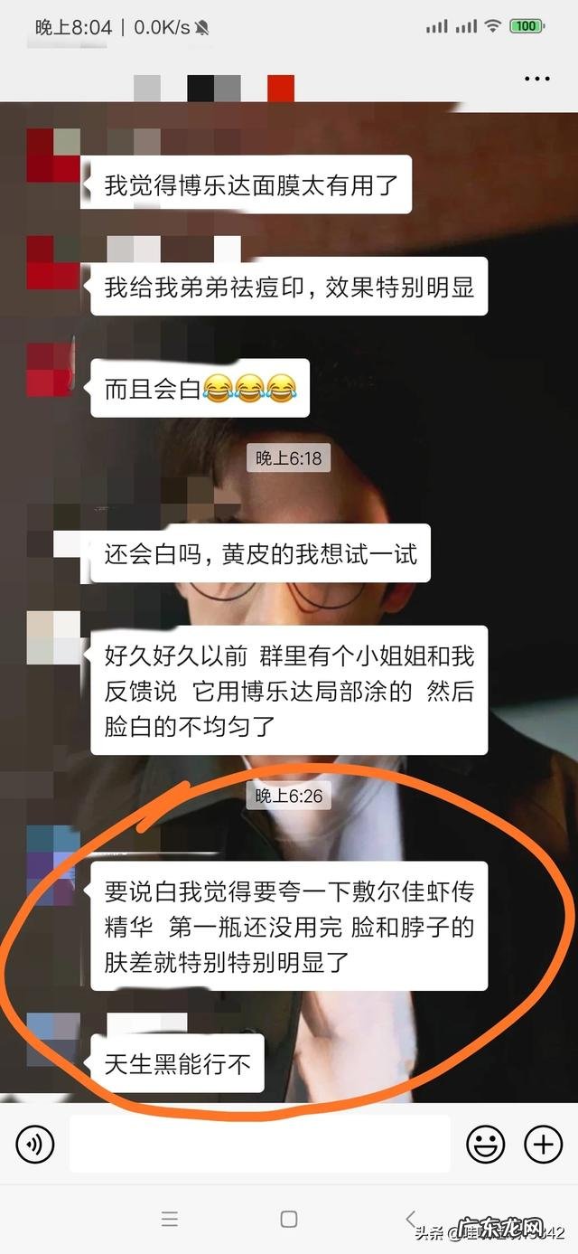 混合型皮肤,刚刚进入美白大军,有什么好用的美白产品可以推荐一下吗?