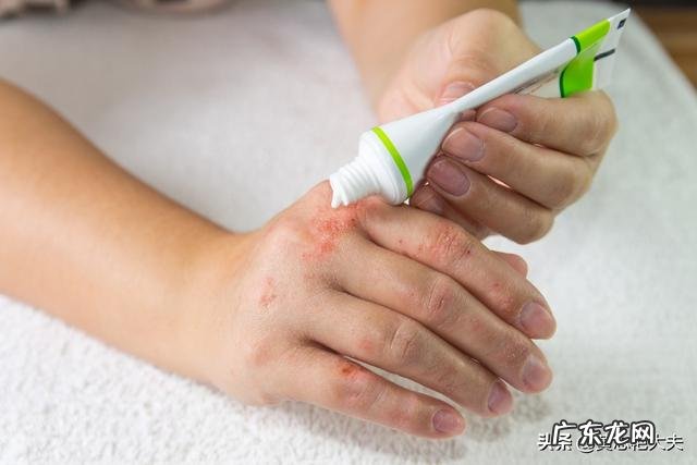 指甲上出现凹横杠是什么病?