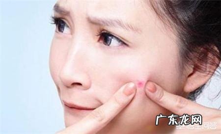 长痘对颜值的影响有多大?