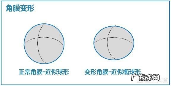 小孩子的眼睛散光能不能治愈？
