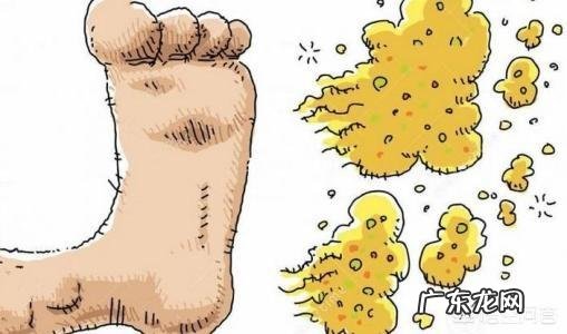 怎样帮助孩子改善脚臭?