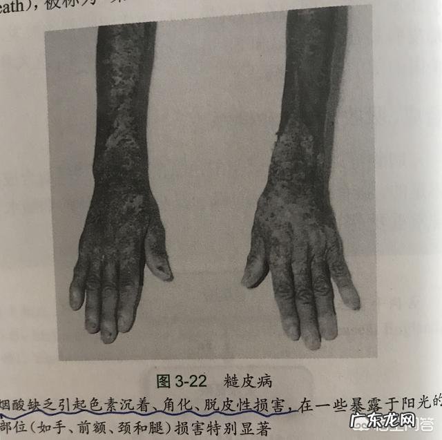 皮肤干燥是因为缺少什么维生素？