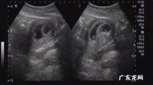 清宫表示看男看女 清宫表测男女准吗?