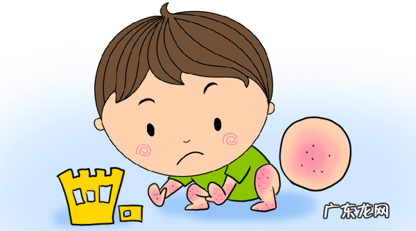 小儿干性湿疹 婴儿湿疹图片