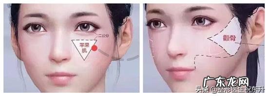苹果肌是不是就是颧骨啊怎样可以有苹果肌?