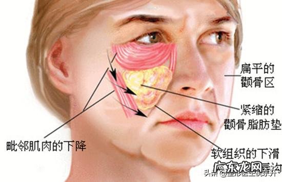 苹果肌是不是就是颧骨啊怎样可以有苹果肌?