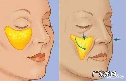 苹果肌是不是就是颧骨啊怎样可以有苹果肌?