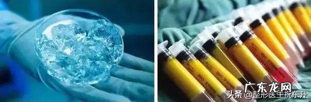 苹果肌是不是就是颧骨啊怎样可以有苹果肌?