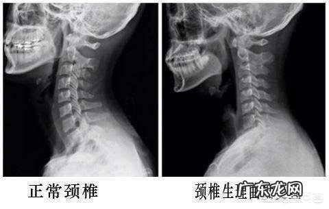 什么样的枕头对颈椎好?