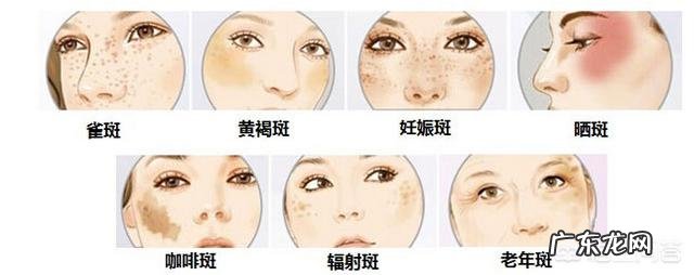 哪种方法祛斑比较好,不反弹无副作用的?