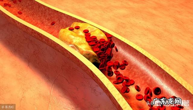 血脂高的人哪些食物不能吃？饮食如何降血脂？