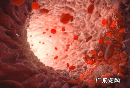 血脂高的人哪些食物不能吃?饮食如何降血脂?