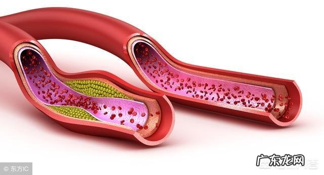 血脂高的人哪些食物不能吃?饮食如何降血脂?