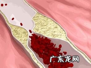 血脂高的人哪些食物不能吃?饮食如何降血脂?