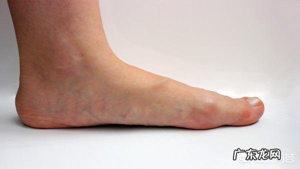 冬季脚臭,有什么除臭办法?