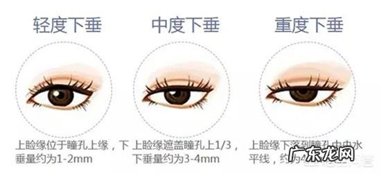 50多岁用,上眼皮下垂得厉害皱纹也比较多,请问什么眼霜可改善?