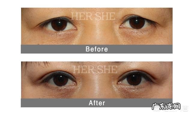 50多岁用,上眼皮下垂得厉害皱纹也比较多,请问什么眼霜可改善?