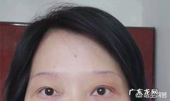 50多岁用,上眼皮下垂得厉害皱纹也比较多,请问什么眼霜可改善?